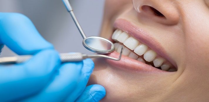 Teeth Whitening Tips and Insights for Long-Lasting Smile Brightness