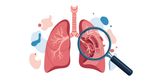 Discover Available Avium Infection Treatment Options for Improved Recovery Support